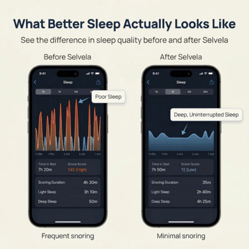 Selvela Anti-Snoring Mouthpiece (Official Retailer) [year]